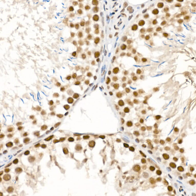 Immunohistochemistry - Anti-ATR (phospho Ser428) Antibody (A91791) - Antibodies.com