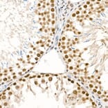 Immunohistochemistry - Anti-ATR (phospho Ser428) Antibody (A91791) - Antibodies.com