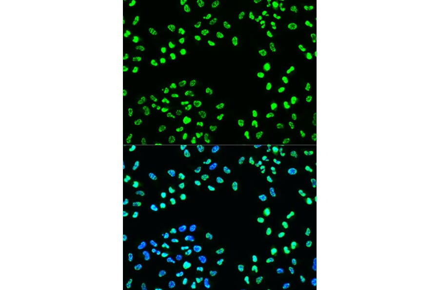 Immunofluorescence - Anti-ATR (phospho Ser428) Antibody (A91791) - Antibodies.com