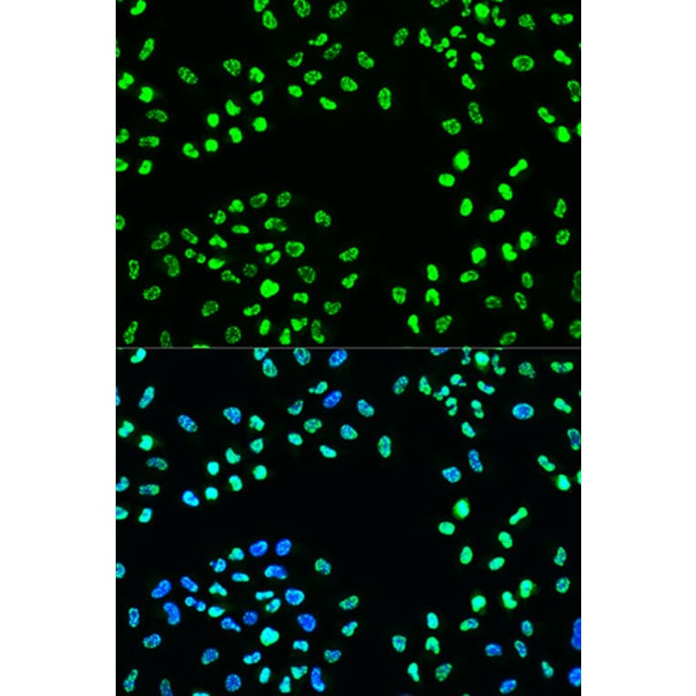 Immunofluorescence - Anti-ATR (phospho Ser428) Antibody (A91791) - Antibodies.com