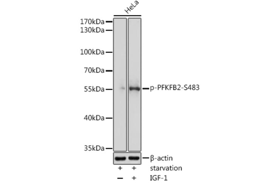 Western Blot - Anti-PFKFB2 (phospho Ser483) Antibody (A91792) - Antibodies.com