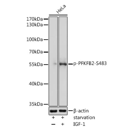 Western Blot - Anti-PFKFB2 (phospho Ser483) Antibody (A91792) - Antibodies.com