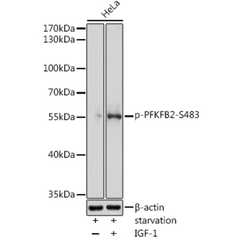 Western Blot - Anti-PFKFB2 (phospho Ser483) Antibody (A91792) - Antibodies.com