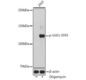 Western Blot - Anti-ULK1 (phospho Ser555) Antibody (A91793) - Antibodies.com
