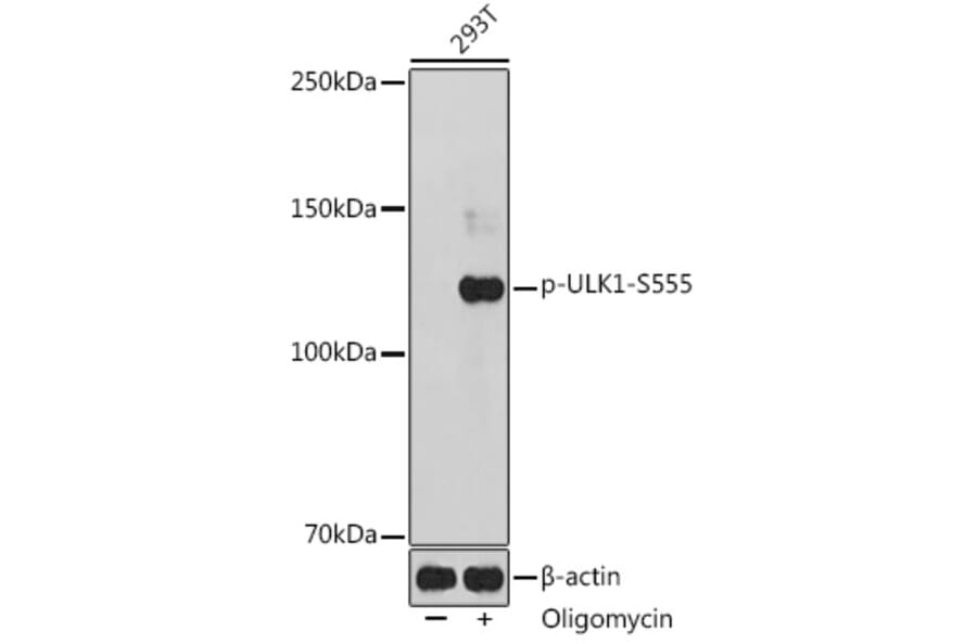 Western Blot - Anti-ULK1 (phospho Ser555) Antibody (A91793) - Antibodies.com