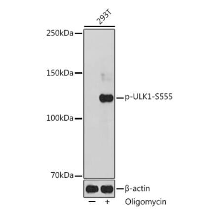 Western Blot - Anti-ULK1 (phospho Ser555) Antibody (A91793) - Antibodies.com
