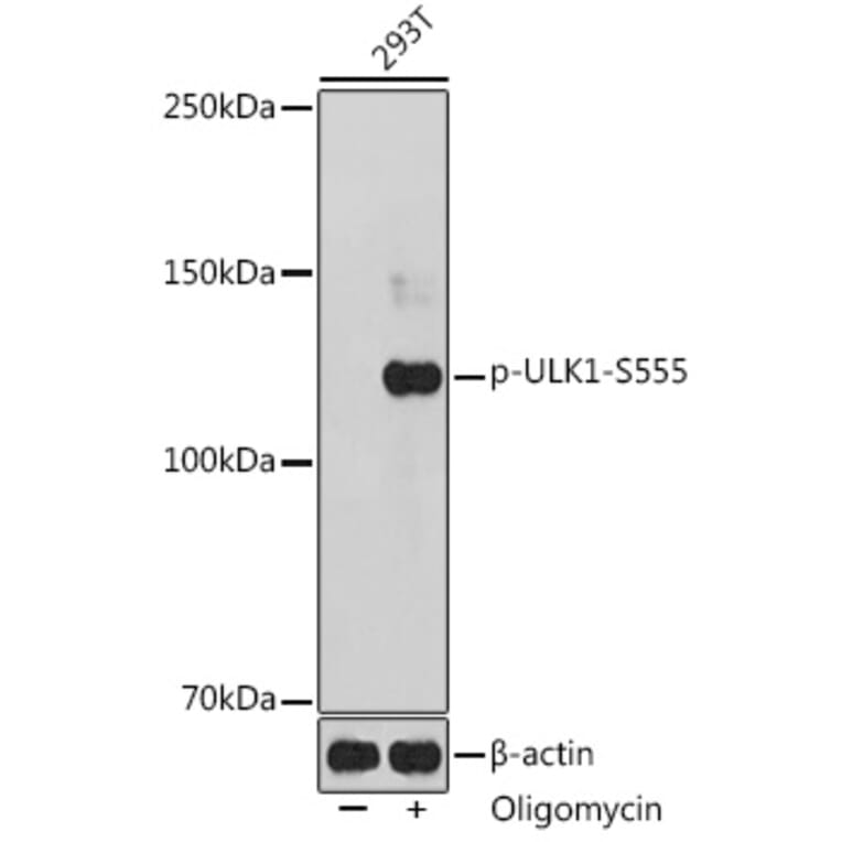 Western Blot - Anti-ULK1 (phospho Ser555) Antibody (A91793) - Antibodies.com