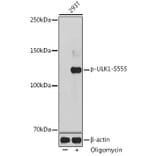 Western Blot - Anti-ULK1 (phospho Ser555) Antibody (A91793) - Antibodies.com