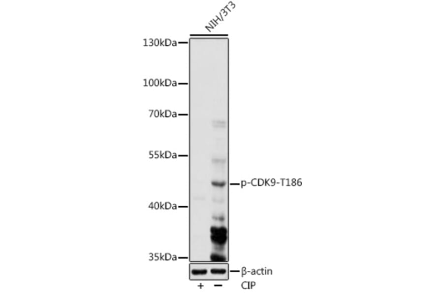 Western Blot - Anti-Cdk9 (phospho Thr186) Antibody (A91795) - Antibodies.com