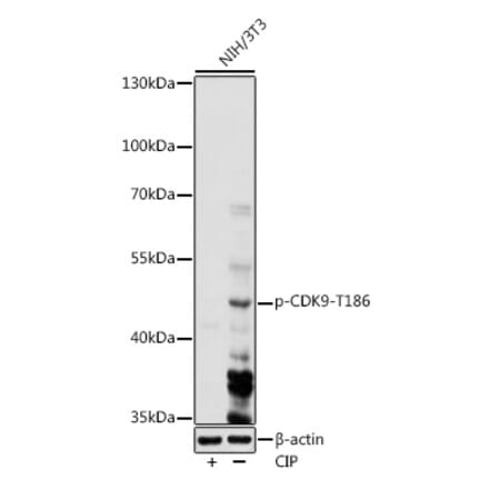 Western Blot - Anti-Cdk9 (phospho Thr186) Antibody (A91795) - Antibodies.com