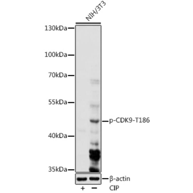 Western Blot - Anti-Cdk9 (phospho Thr186) Antibody (A91795) - Antibodies.com