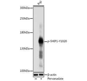 Western Blot - Anti-SHIP-1 (phospho Tyr1020) Antibody (A91800) - Antibodies.com