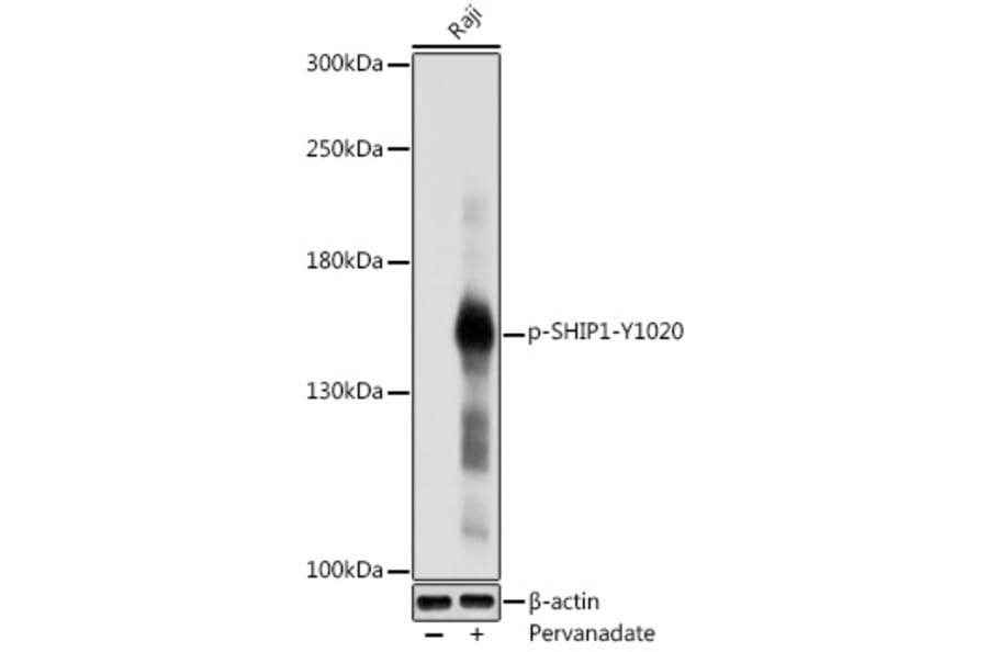 Western Blot - Anti-SHIP-1 (phospho Tyr1020) Antibody (A91800) - Antibodies.com