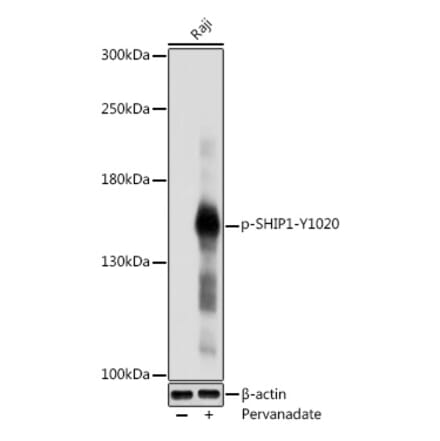 Western Blot - Anti-SHIP-1 (phospho Tyr1020) Antibody (A91800) - Antibodies.com