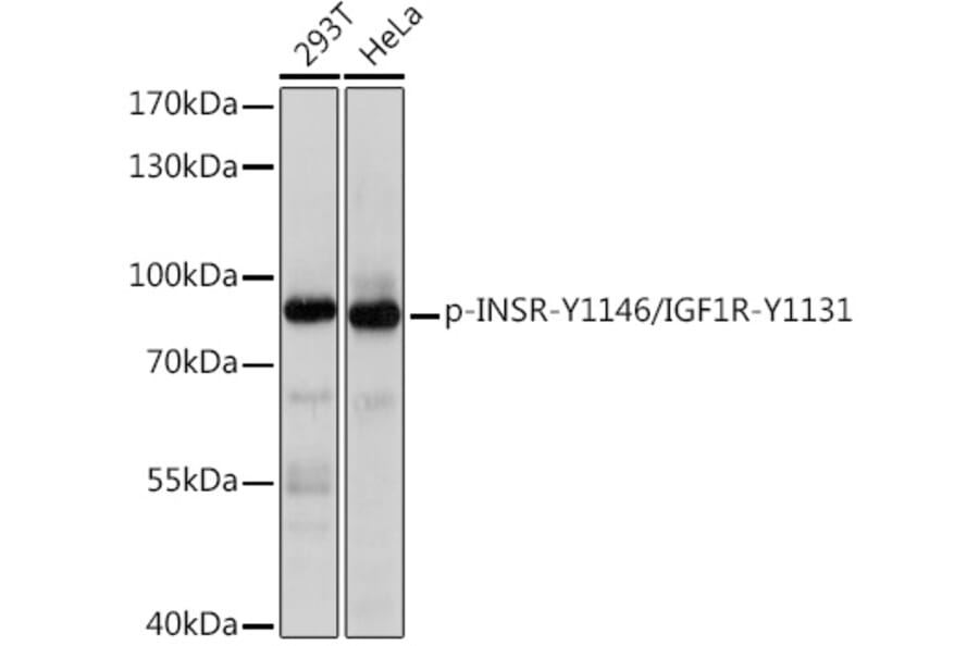 Western Blot - Anti-Insulin Receptor (phospho Tyr1146) + IGF1 Receptor (phospho Tyr1131) Antibody (A91801) - Antibodies.com