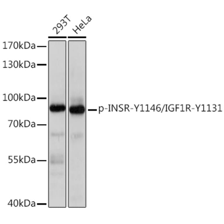 Western Blot - Anti-Insulin Receptor (phospho Tyr1146) + IGF1 Receptor (phospho Tyr1131) Antibody (A91801) - Antibodies.com