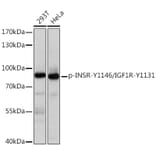 Western Blot - Anti-Insulin Receptor (phospho Tyr1146) + IGF1 Receptor (phospho Tyr1131) Antibody (A91801) - Antibodies.com