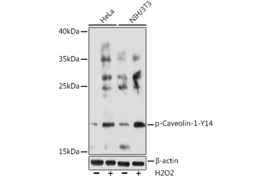 Western Blot - Anti-Caveolin 1 (phospho Tyr14) Antibody (A91802) - Antibodies.com