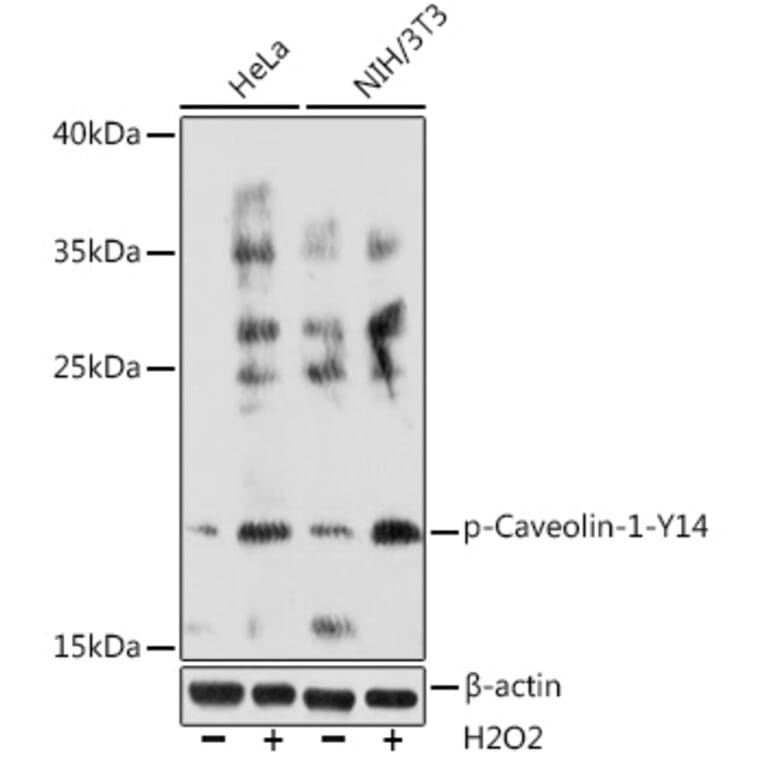 Western Blot - Anti-Caveolin 1 (phospho Tyr14) Antibody (A91802) - Antibodies.com