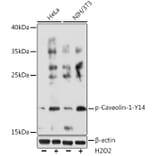 Western Blot - Anti-Caveolin 1 (phospho Tyr14) Antibody (A91802) - Antibodies.com