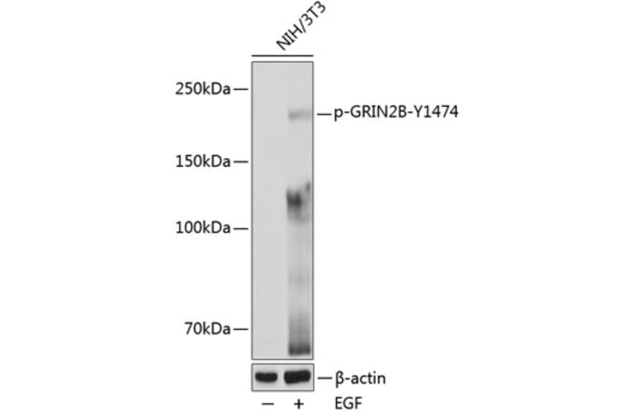 Western Blot - Anti-NMDAR2B (phospho Tyr1474) Antibody (A91803) - Antibodies.com