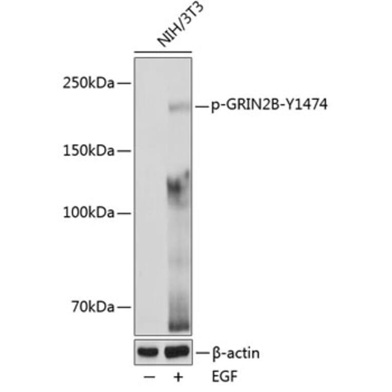 Western Blot - Anti-NMDAR2B (phospho Tyr1474) Antibody (A91803) - Antibodies.com