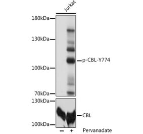 Western Blot - Anti-CBL (phospho Tyr774) Antibody (A91808) - Antibodies.com
