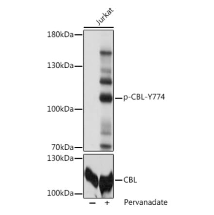 Western Blot - Anti-CBL (phospho Tyr774) Antibody (A91808) - Antibodies.com