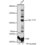 Western Blot - Anti-CBL (phospho Tyr774) Antibody (A91808) - Antibodies.com