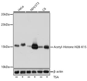 Western Blot - Anti-Histone H2B (acetyl Lys15) Antibody (A91809) - Antibodies.com