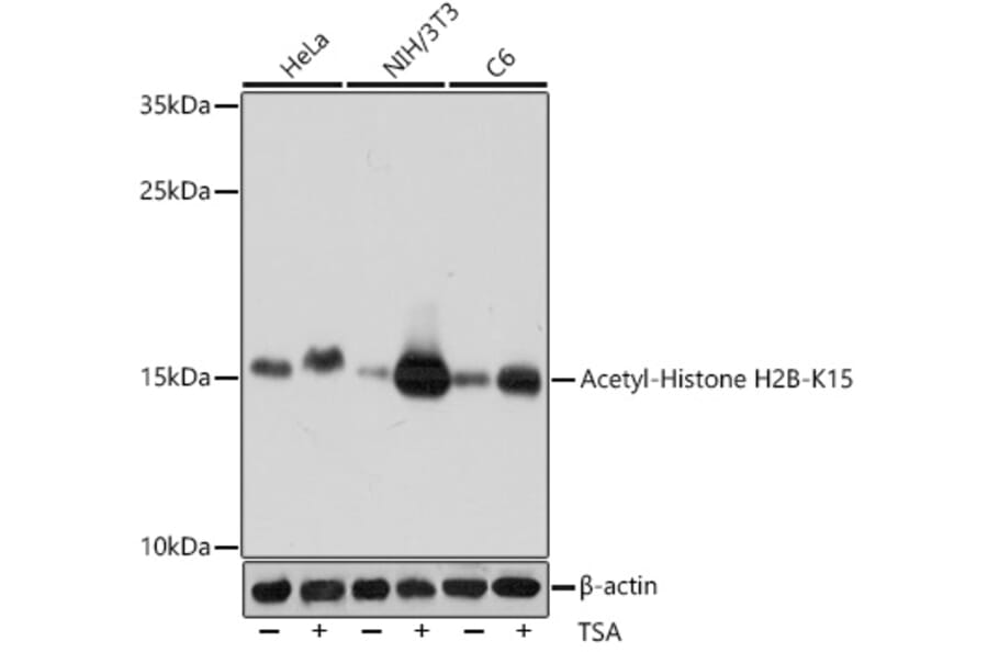 Western Blot - Anti-Histone H2B (acetyl Lys15) Antibody (A91809) - Antibodies.com