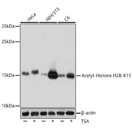 Western Blot - Anti-Histone H2B (acetyl Lys15) Antibody (A91809) - Antibodies.com