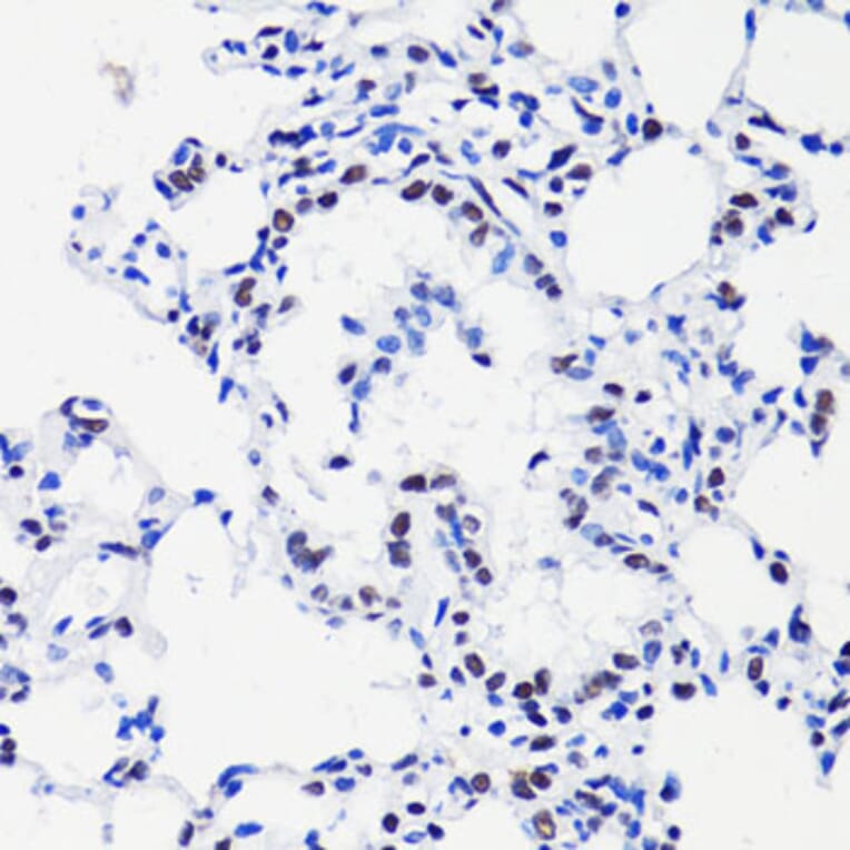 Immunohistochemistry - Anti-Histone H2B (acetyl Lys15) Antibody (A91809) - Antibodies.com