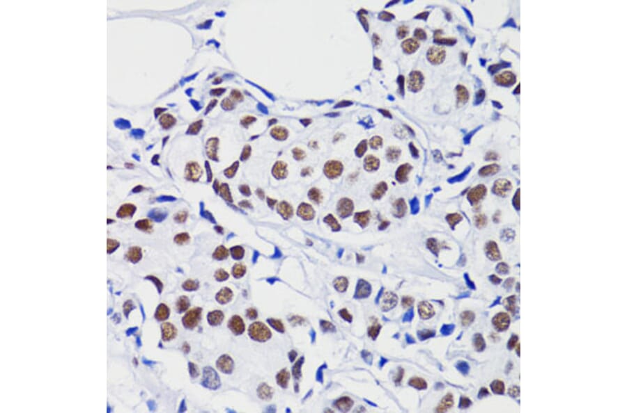 Immunohistochemistry - Anti-Histone H2B (acetyl Lys15) Antibody (A91809) - Antibodies.com