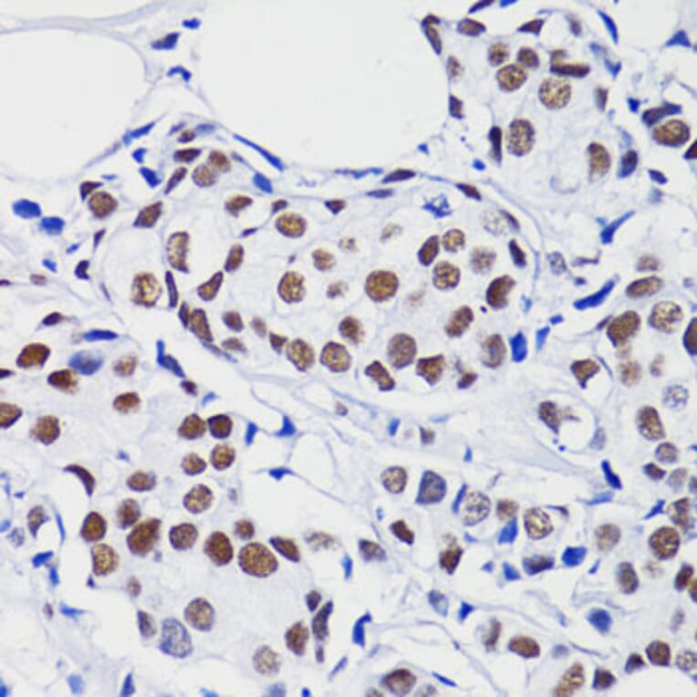 Immunohistochemistry - Anti-Histone H2B (acetyl Lys15) Antibody (A91809) - Antibodies.com