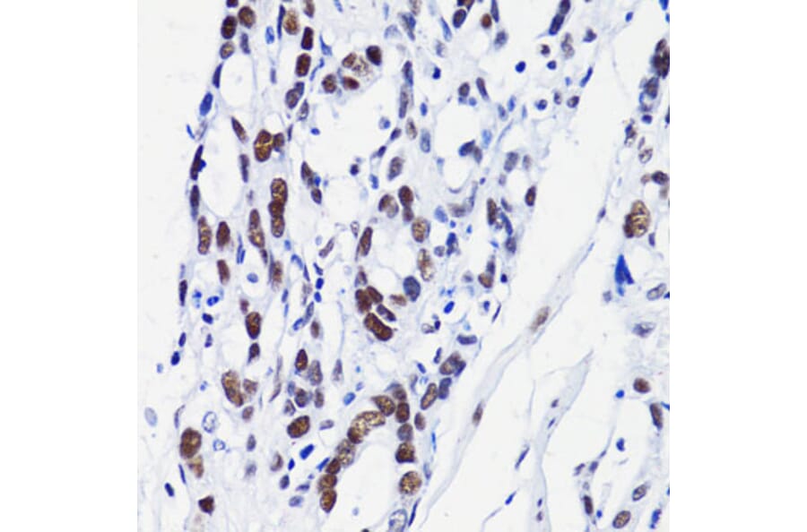 Immunohistochemistry - Anti-Histone H2B (acetyl Lys15) Antibody (A91809) - Antibodies.com