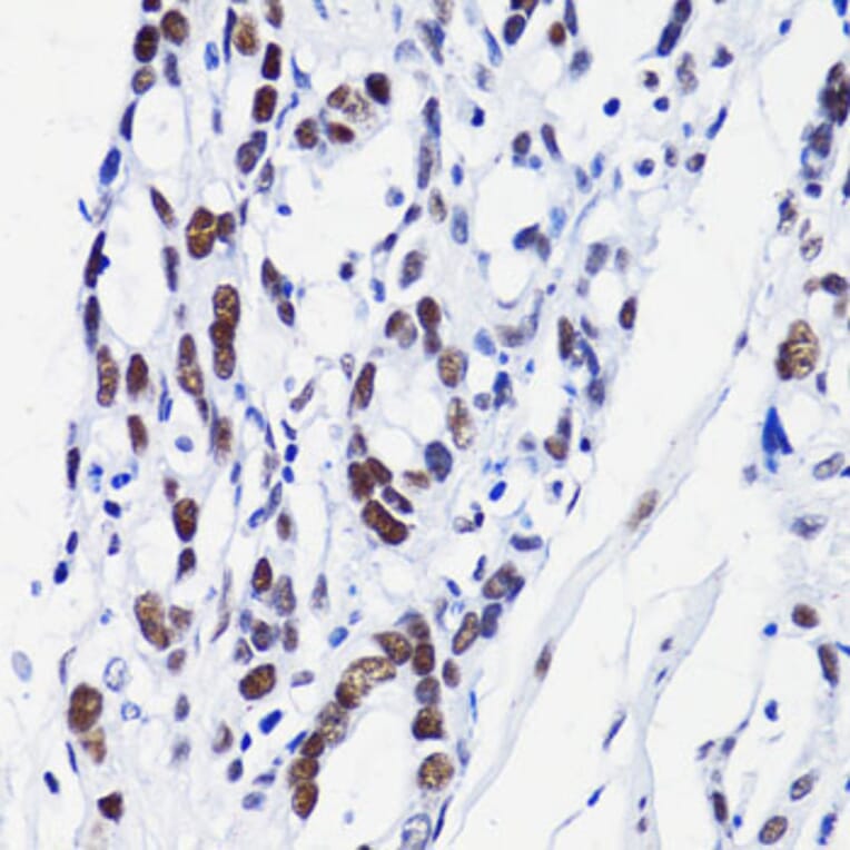 Immunohistochemistry - Anti-Histone H2B (acetyl Lys15) Antibody (A91809) - Antibodies.com