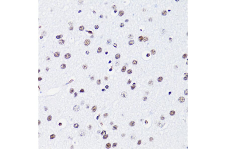 Immunohistochemistry - Anti-Histone H2B (acetyl Lys15) Antibody (A91809) - Antibodies.com