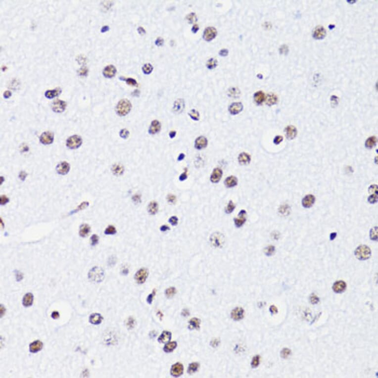 Immunohistochemistry - Anti-Histone H2B (acetyl Lys15) Antibody (A91809) - Antibodies.com