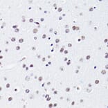 Immunohistochemistry - Anti-Histone H2B (acetyl Lys15) Antibody (A91809) - Antibodies.com