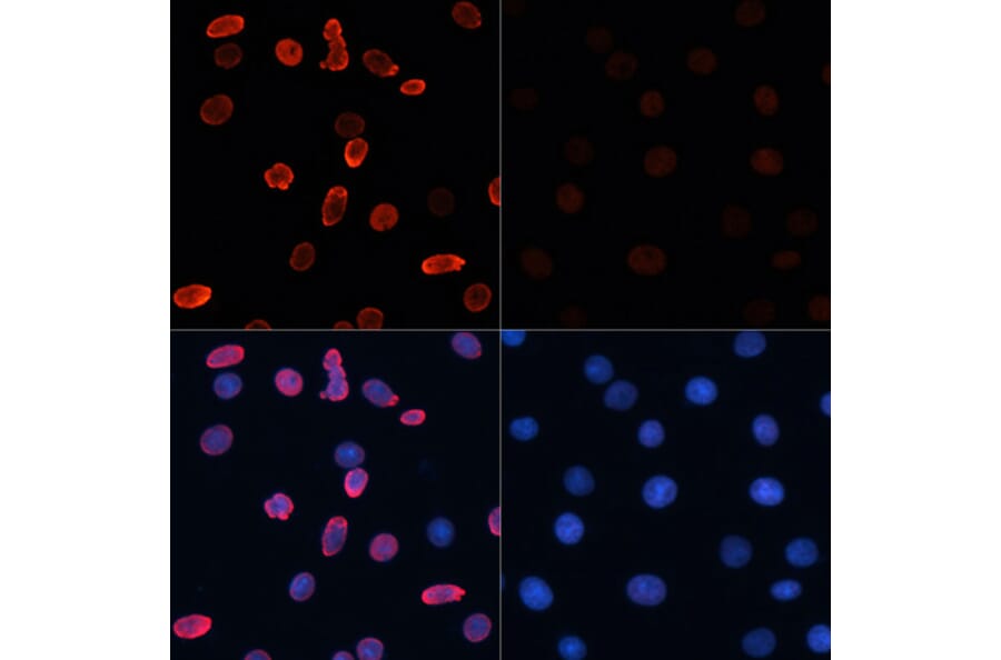 Immunofluorescence - Anti-Histone H2B (acetyl Lys15) Antibody (A91809) - Antibodies.com