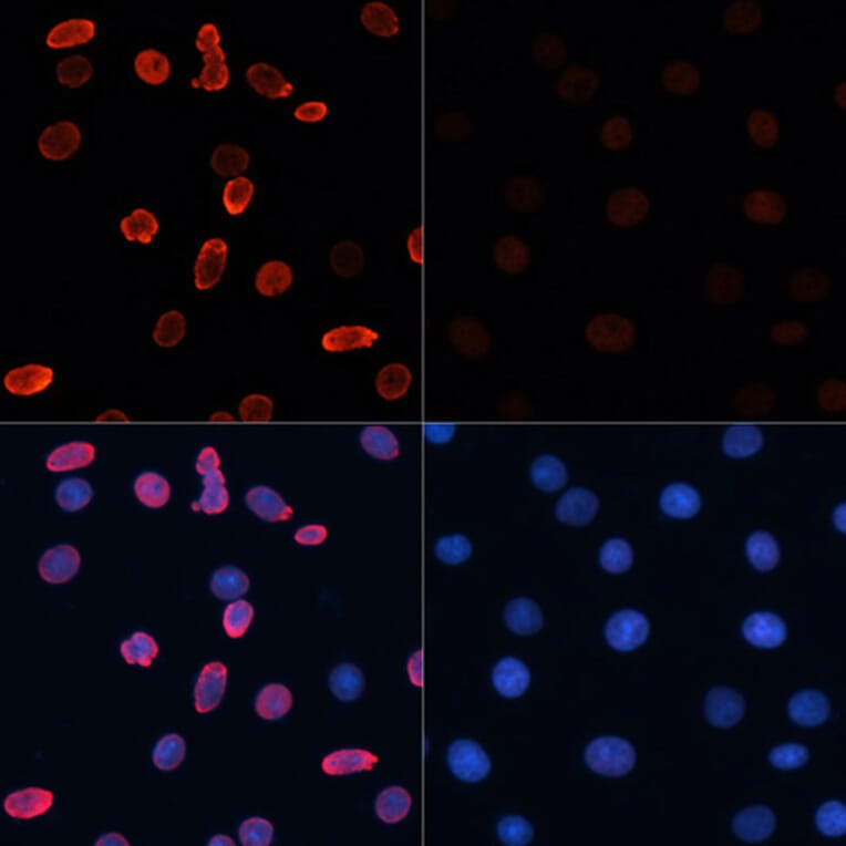 Immunofluorescence - Anti-Histone H2B (acetyl Lys15) Antibody (A91809) - Antibodies.com