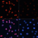 Immunofluorescence - Anti-Histone H2B (acetyl Lys15) Antibody (A91809) - Antibodies.com