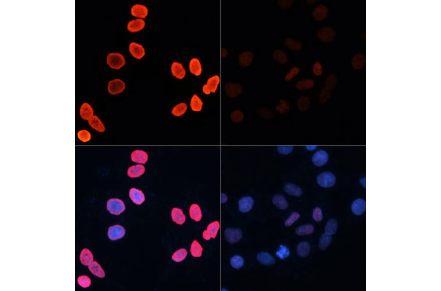 Immunofluorescence - Anti-Histone H2B (acetyl Lys15) Antibody (A91809) - Antibodies.com
