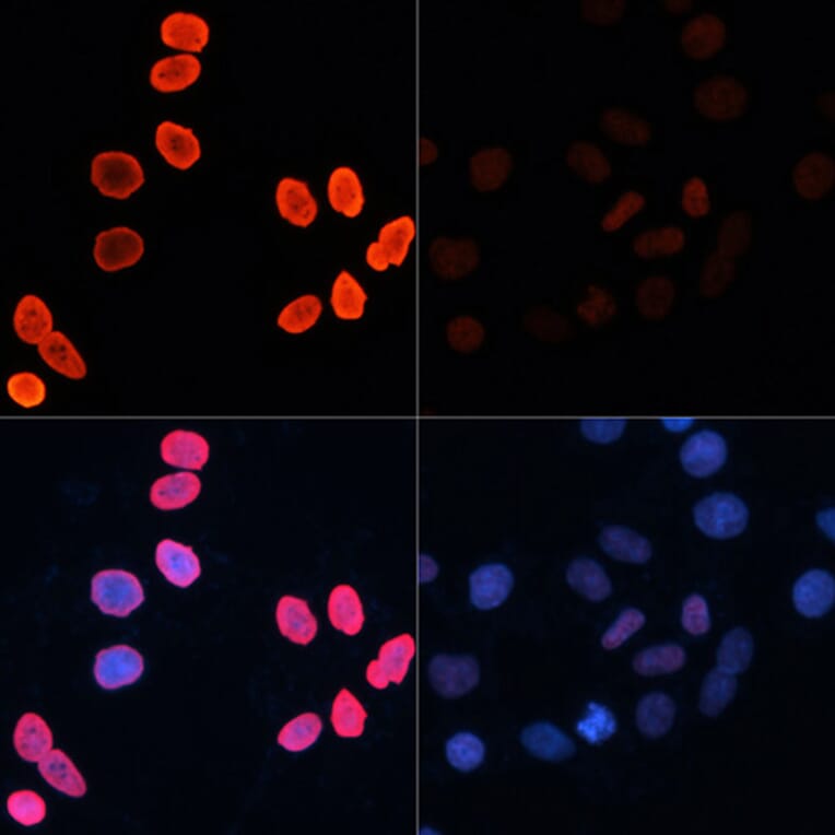 Immunofluorescence - Anti-Histone H2B (acetyl Lys15) Antibody (A91809) - Antibodies.com