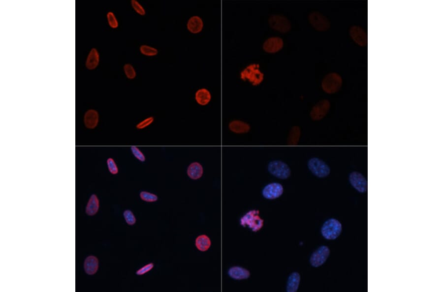 Immunofluorescence - Anti-Histone H2B (acetyl Lys15) Antibody (A91809) - Antibodies.com