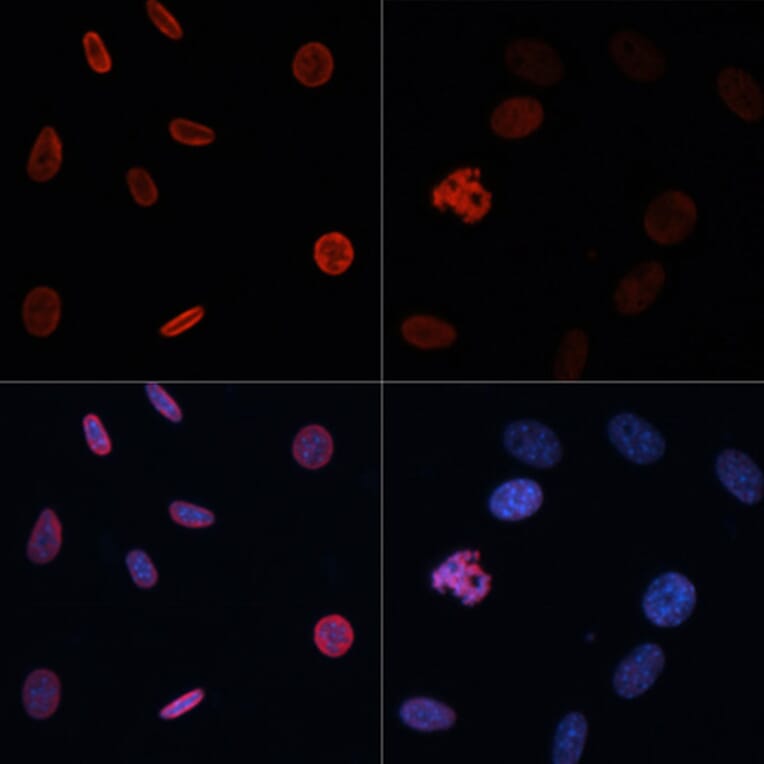 Immunofluorescence - Anti-Histone H2B (acetyl Lys15) Antibody (A91809) - Antibodies.com