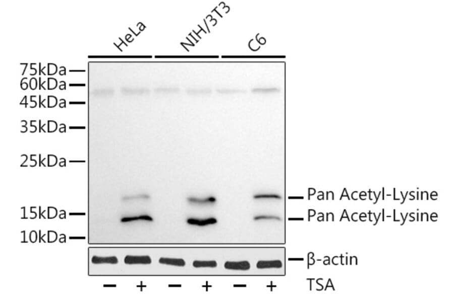 Western Blot - Anti-Pan Acetyl-Lysine Antibody [AMC0491] (A91810) - Antibodies.com
