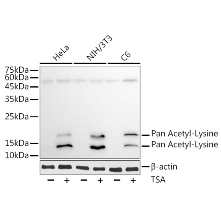 Western Blot - Anti-Pan Acetyl-Lysine Antibody [AMC0491] (A91810) - Antibodies.com