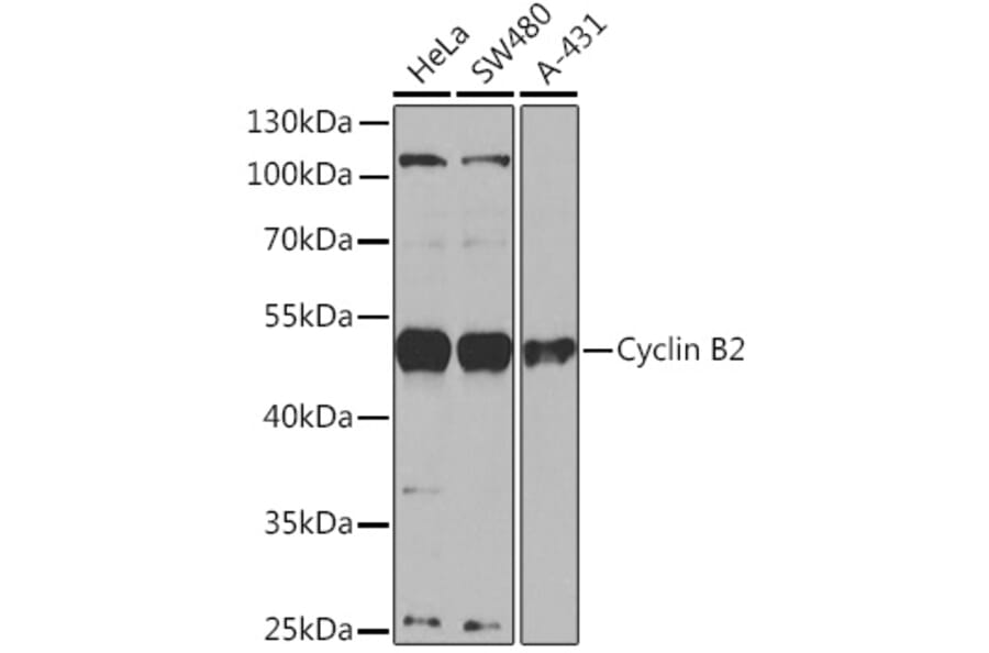 Western Blot - Anti-Cyclin B2 Antibody (A91816) - Antibodies.com